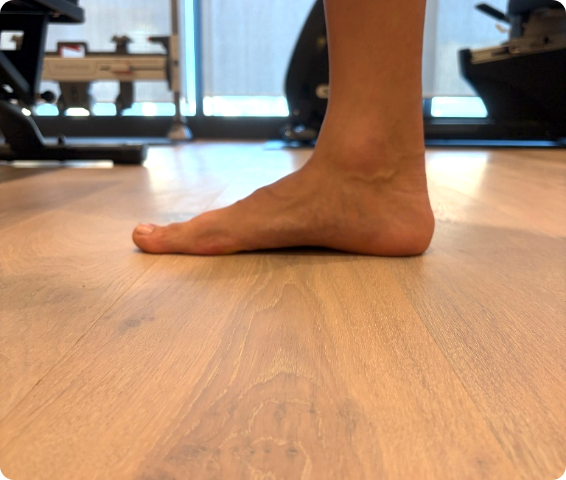 足部アーチを確認する様子